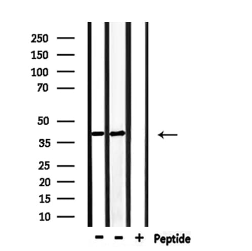 CDK5R2 Antibody