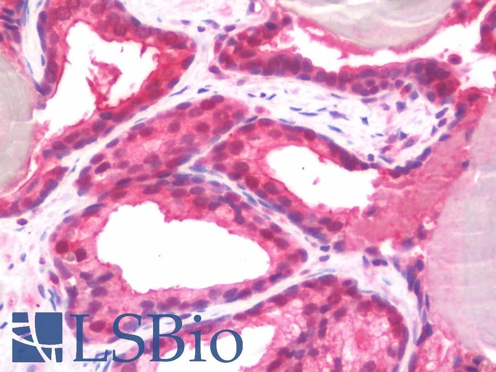 IHC-plus™ MTOR Antibody