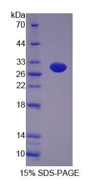 Rat GFM2 Protein (Recombinant His, N-Terminal)