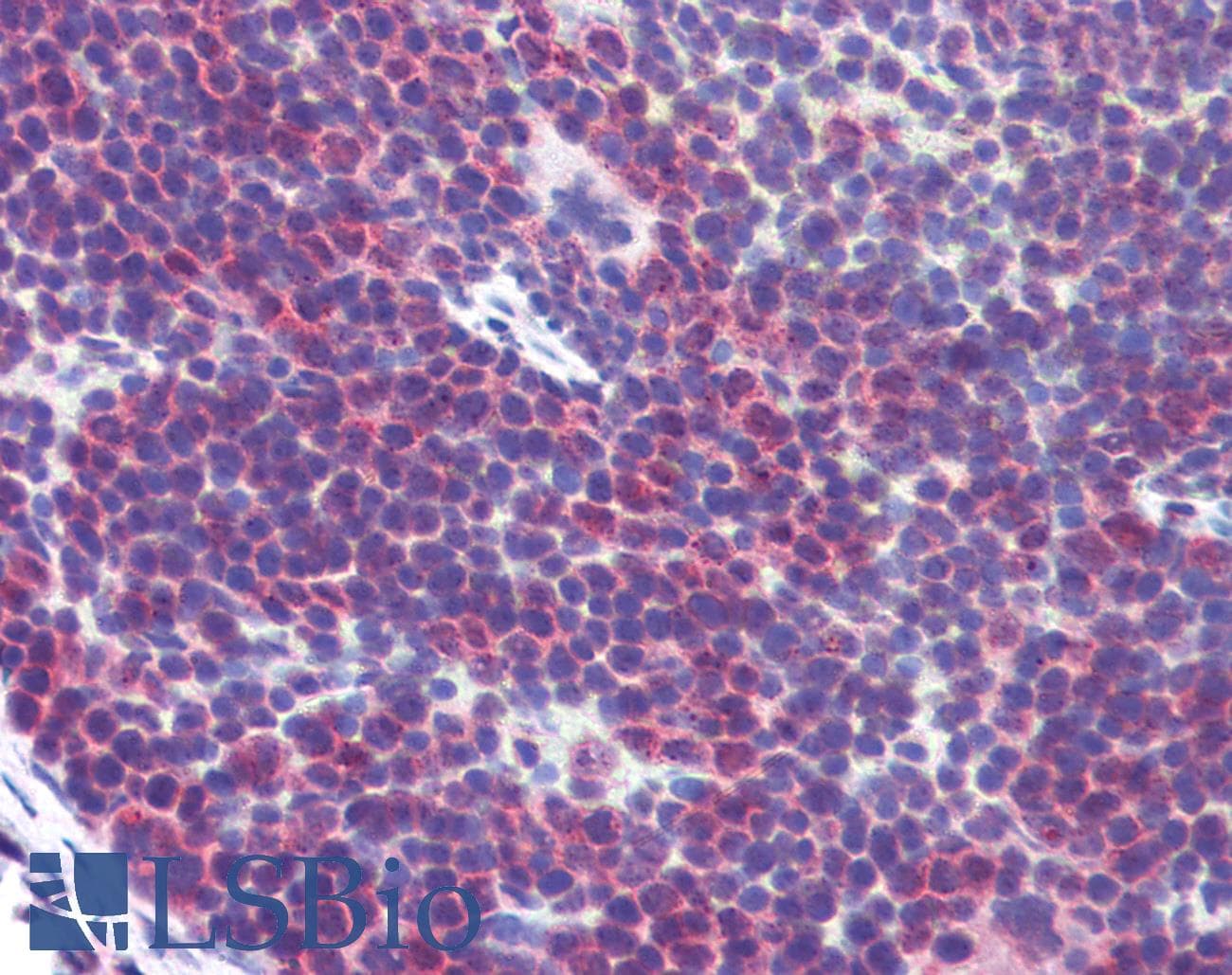IHC-plus™ CD36 Antibody (aa99-114)