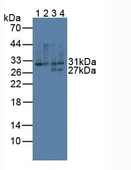 CD74 / CLIP Antibody