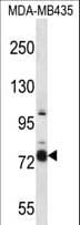 Polyclonal Rabbit anti-Human CASS4 Antibody (aa610-639, WB)
