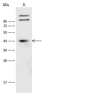 CLN8 Antibody (Preservative Free)