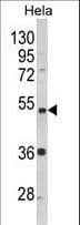 Polyclonal Rabbit anti-Human PPP2R2B Antibody (aa104-130, IHC, IF, WB)