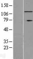 RNF40 / STARING Protein (Over-Expression Lysate Myc-DDK (Flag))