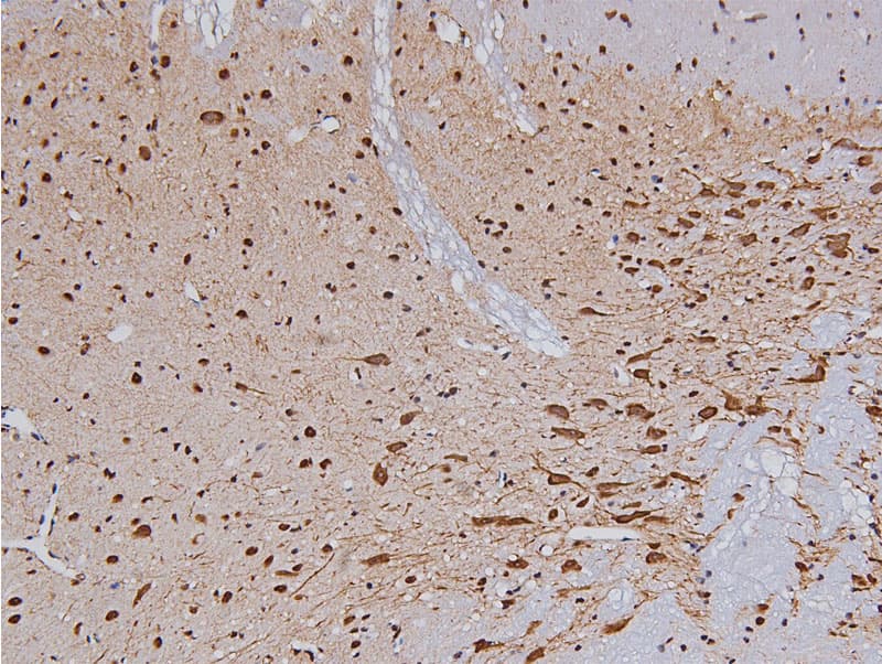 Polyclonal Rabbit anti-Human TH / Tyrosine Hydroxylase Antibody (phospho-Ser19, IHC, IF, WB)