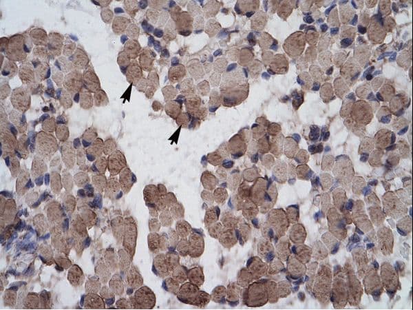 Polyclonal Rabbit anti-Human LHX9 Antibody (aa324-373, IHC, WB)