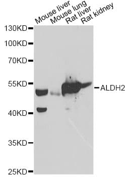 ALDH2 Antibody