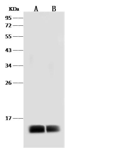 Polyclonal Rabbit anti-Dengue Virus Type 2 Dengue Virus Type 2 Envelope Antibody (Preservative Free, IHC, IF, WB)