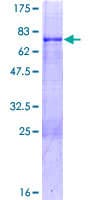 Human MKX Protein (Recombinant GST)