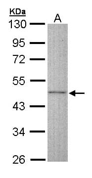 DCX / Doublecortin Antibody