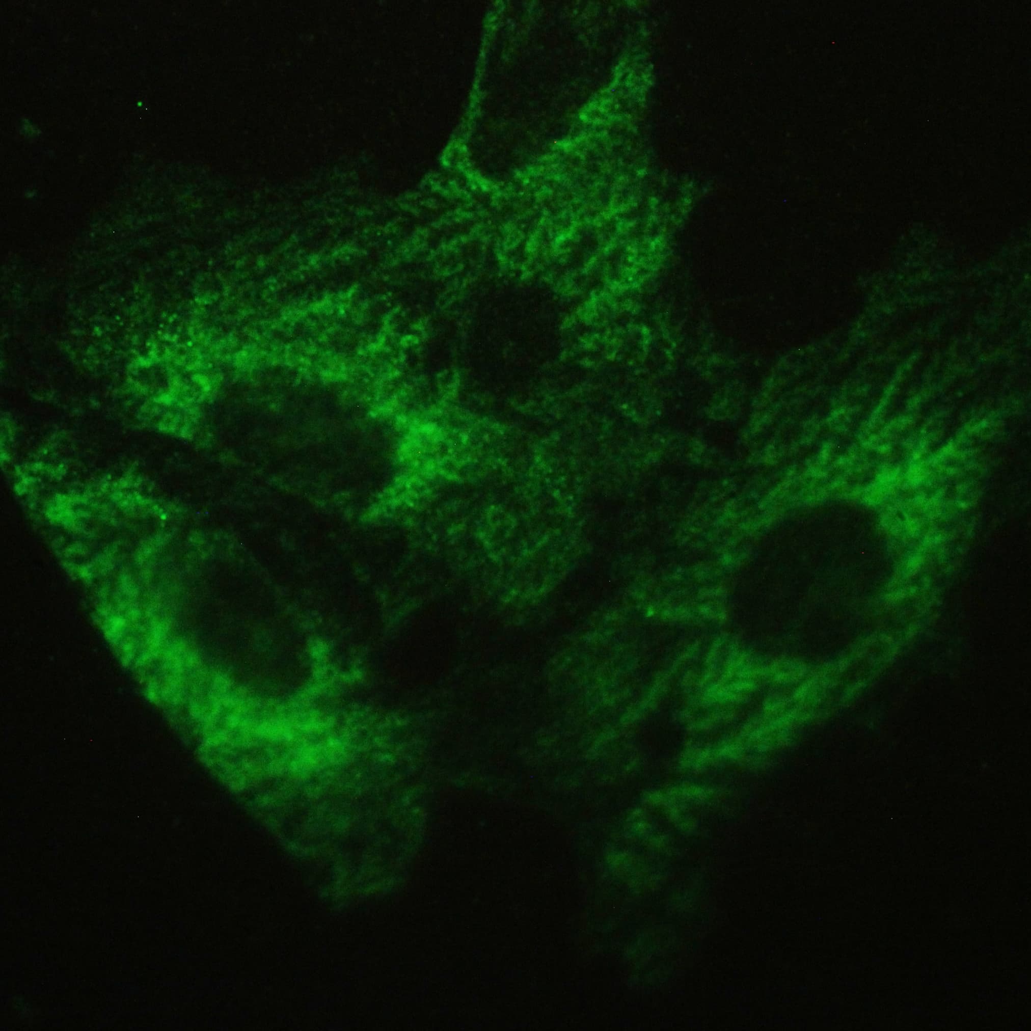 ATXN2 / SCA2 / Ataxin-2 Antibody (aa1293-1313)