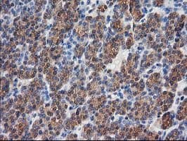 DSTN / Destrin Antibody (clone OTI2F7)
