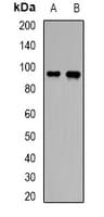 Polyclonal Rabbit anti-Human ABCC4 / MRP4 Antibody (WB)