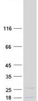Human NIP7 Protein (Recombinant Myc-DDK (Flag))