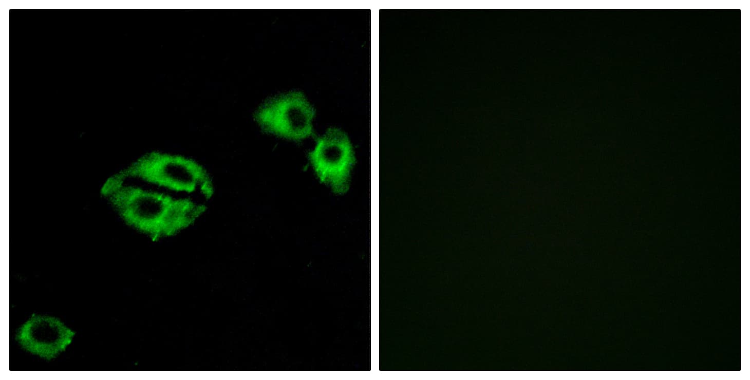 IHC-plus™ Polyclonal Rabbit anti-Human NPY5R Antibody (aa221-270, IHC, IF, WB)