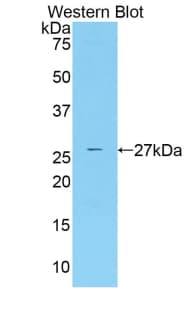 CBFA1 / RUNX2 Antibody (aa125-352)