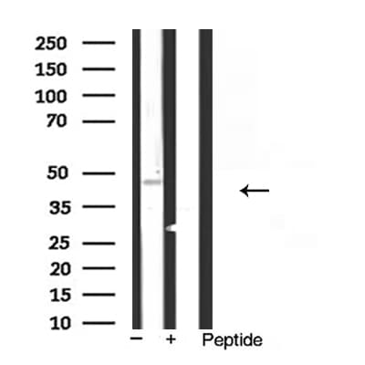 KCNJ11 / Kir6.2 Antibody