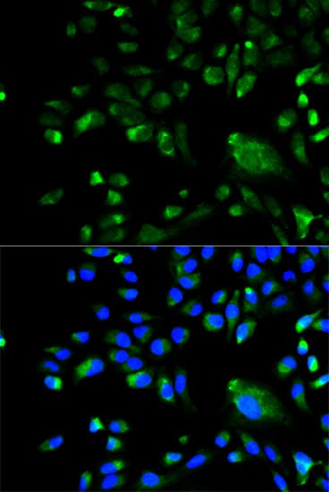BCL10 / BCL-10 Antibody (aa1-233)