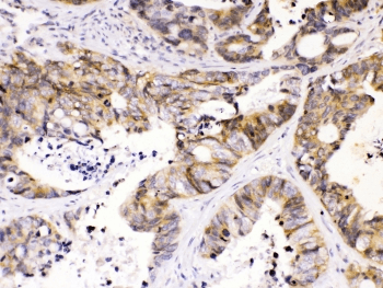 NDRG3 Antibody
