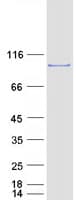 Human ESYT2 / E-Syt2 Protein (Recombinant Myc-DDK (Flag))