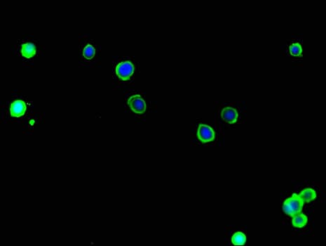 SLC9A1 / NHE1 Antibody