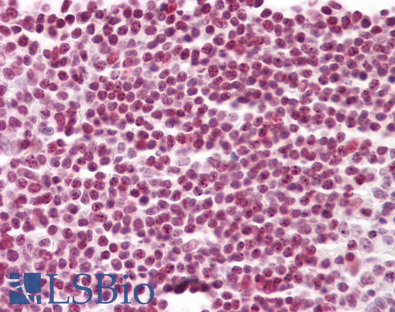 IHC-plus™ Polyclonal Rabbit anti-Human Histone H2B Antibody (aa11-60, IHC, WB)