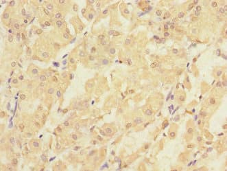 Polyclonal Rabbit anti-Human PMM2 Antibody (IHC, WB)