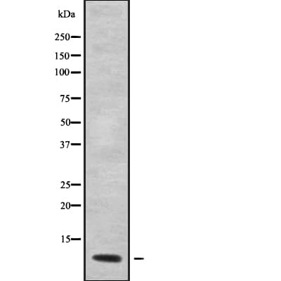Polyclonal Rabbit anti-Human GNG12 Antibody (IHC, WB)