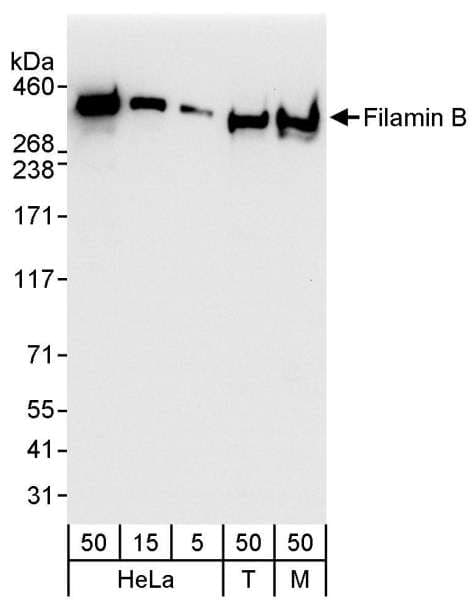 FLNB / TAP Antibody (aa2552-2602)