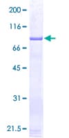 Human GSS / Glutathione Synthetase Protein (Recombinant GST)