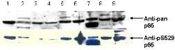 RELA / NFKB p65 Antibody (phospho-Ser276)