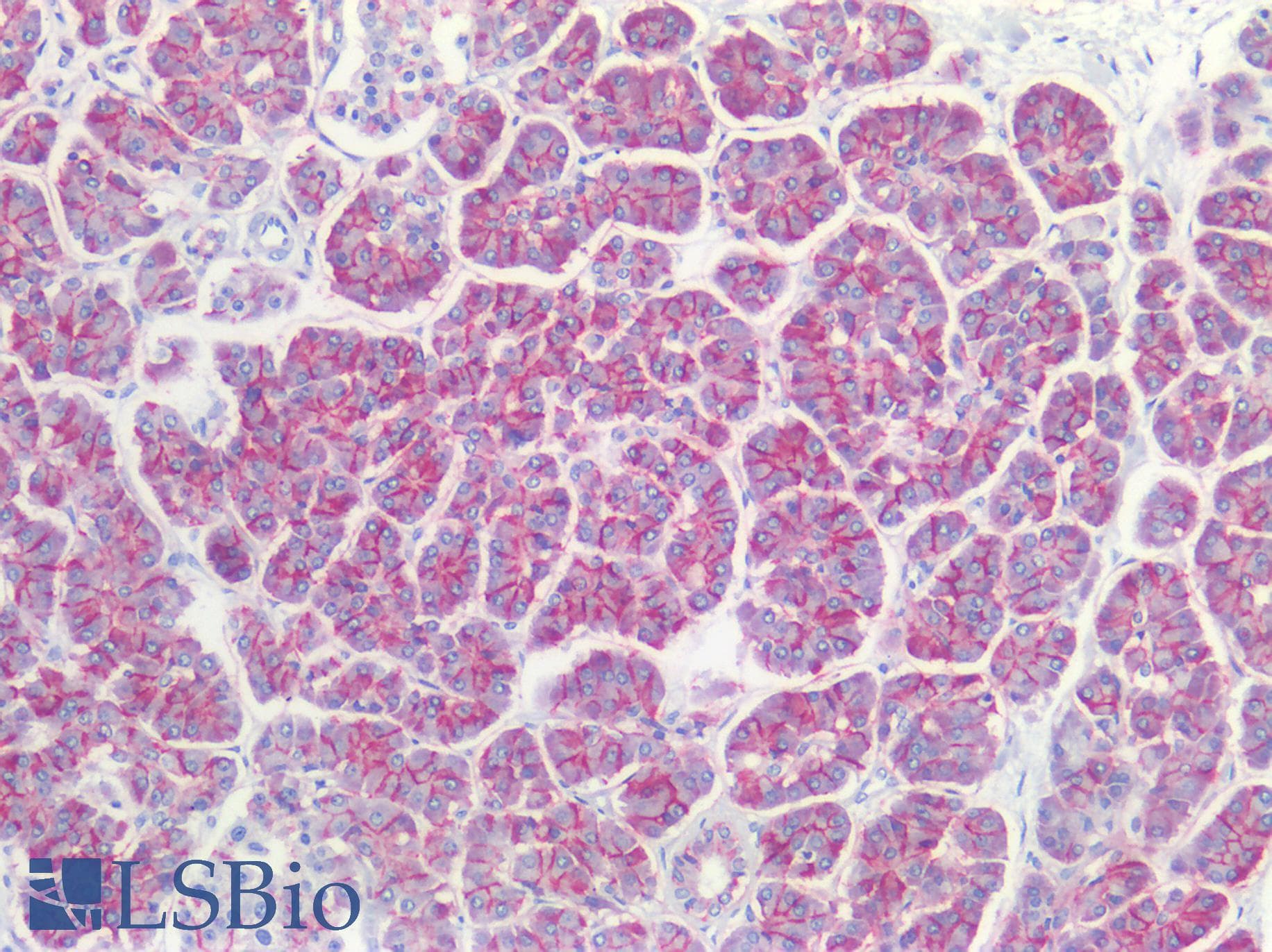 PathPlus™ Polyclonal Rabbit anti-Human CLDN3 / Claudin 3 Antibody (C-Terminus, IHC, IF, WB)