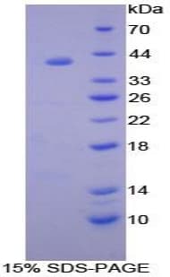 Human BAFF Receptor / CD268 Protein (Recombinant His-GST)