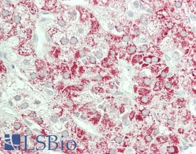 IHC-plus™ Polyclonal Rabbit anti-Human EIF4G1 / EIF4G Antibody (Internal, IHC, IF, WB)