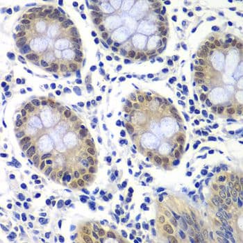 RAP30 / GTF2F2 Antibody