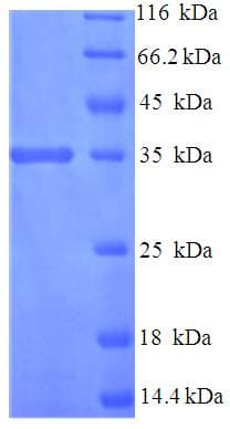 Human TMX3 Protein (Recombinant His-SUMO)