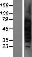 TSPY1 / TSPY Protein (Over-Expression Lysate Myc-DDK (Flag))