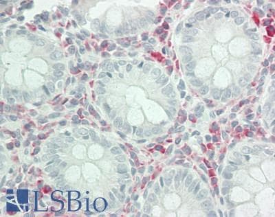 IHC-plus™ Polyclonal Rabbit anti-Human UBFD1 Antibody (C-Terminus, IHC, WB)