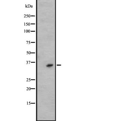 KLK6 / Kallikrein 6 Antibody