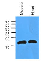 PathPlus™ Monoclonal Mouse anti-Human MB / Myoglobin Antibody (clone AT6E10, IHC, WB)