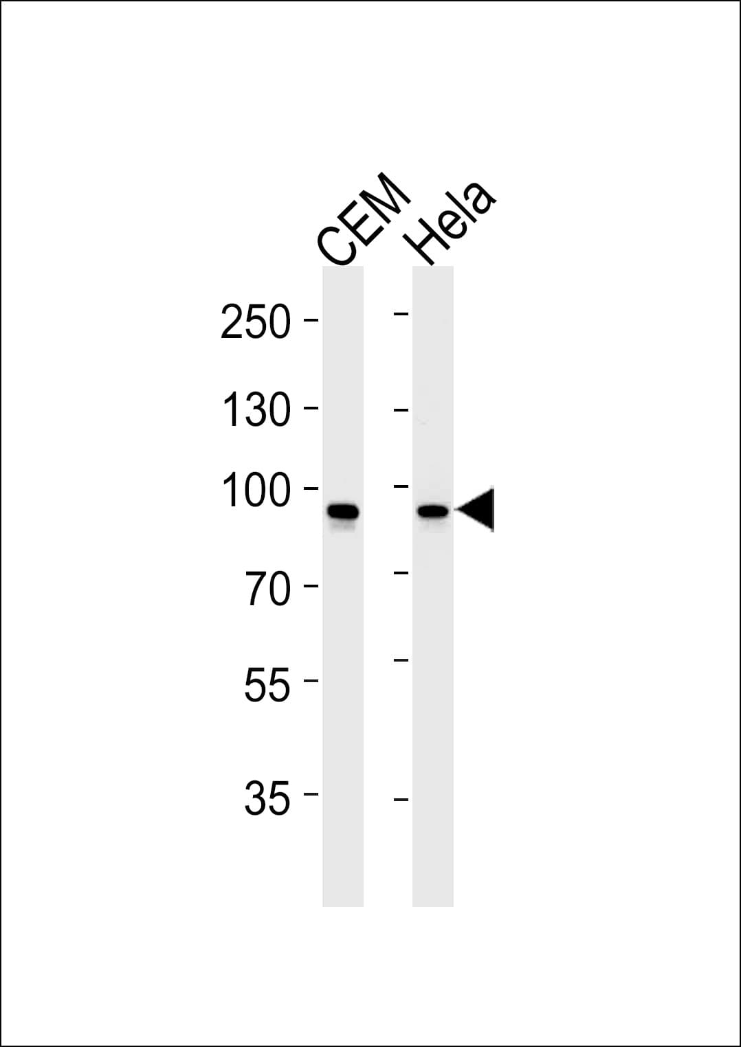 Monoclonal Mouse anti-Human STAT1 Antibody (clone 1141CT26.2.1, WB)