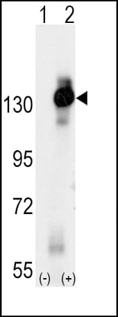 CSF1R / CD115 / FMS Antibody (aa940-971)