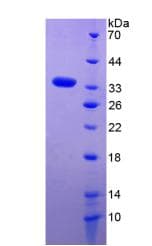 Mouse ANGPTL4 Protein (Recombinant His-S)