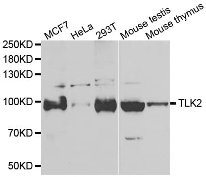 TLK2 Antibody