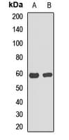 Polyclonal Rabbit anti-Human C6orf150 / MB21D1 Antibody (IHC, WB)