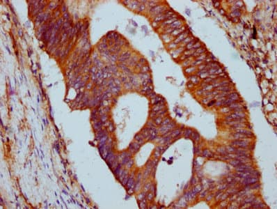 GLRX5 / Glutaredoxin 5 Antibody