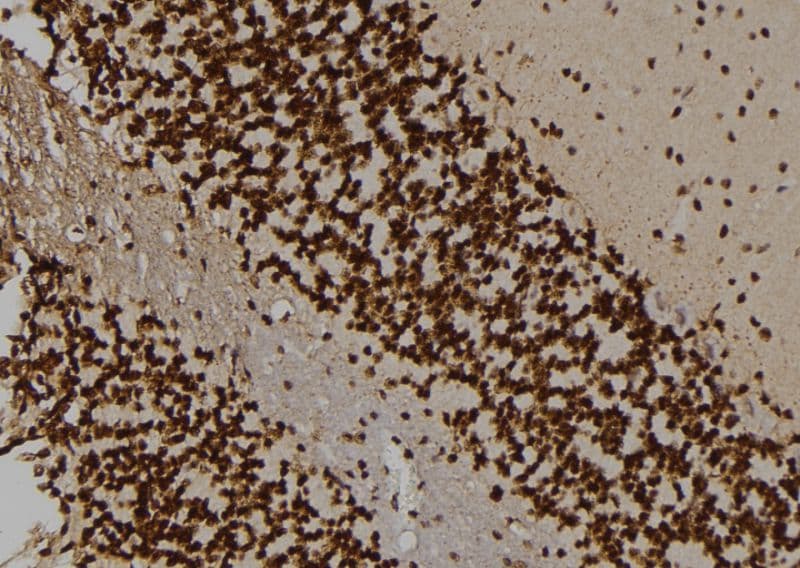 Polyclonal Rabbit anti-Human HAK / ALPK2 Antibody (IHC, WB)