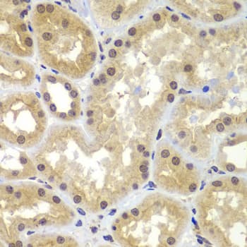 Polyclonal Rabbit anti-Human CEBPG / CEBP Gamma Antibody (IHC, IF, WB)
