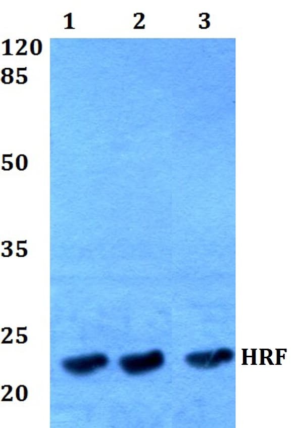 IHC-plus™ Polyclonal Rabbit anti-Human TPT1 / TCTP Antibody (aa70-120, IHC, IF, WB)